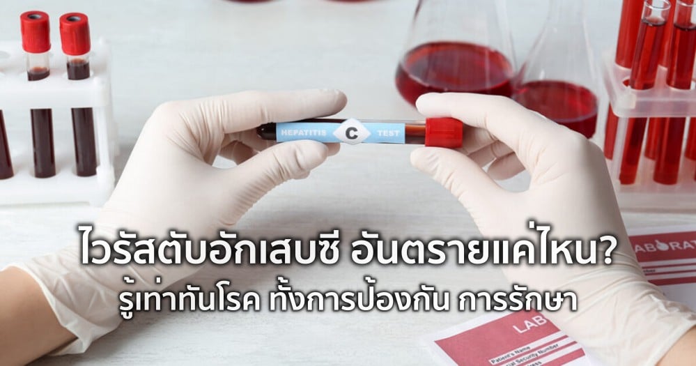 ไวรัสตับอักเสบซี อันตรายแค่ไหน รู้เท่าทันโรค ทั้งการป้องกัน - การรักษา